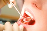 В 2010 году здоровые зубы обошлись россиянам в 360 млн долларов